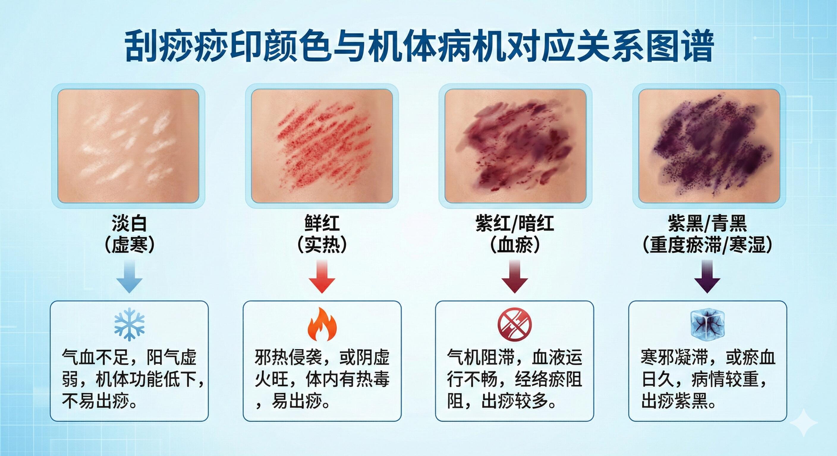 手把手中医刮痧完整教程