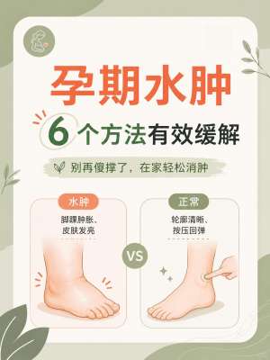 孕期水肿消除全攻略|产科专家权威详解