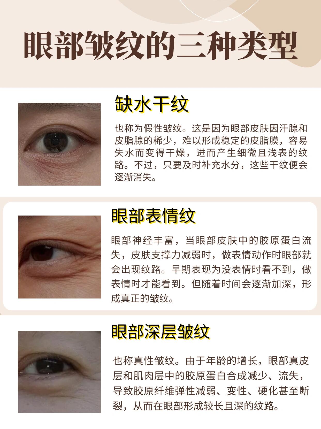 眼霜用户评价核心要点全面解析|消费者真实决策心智&口碑拆解