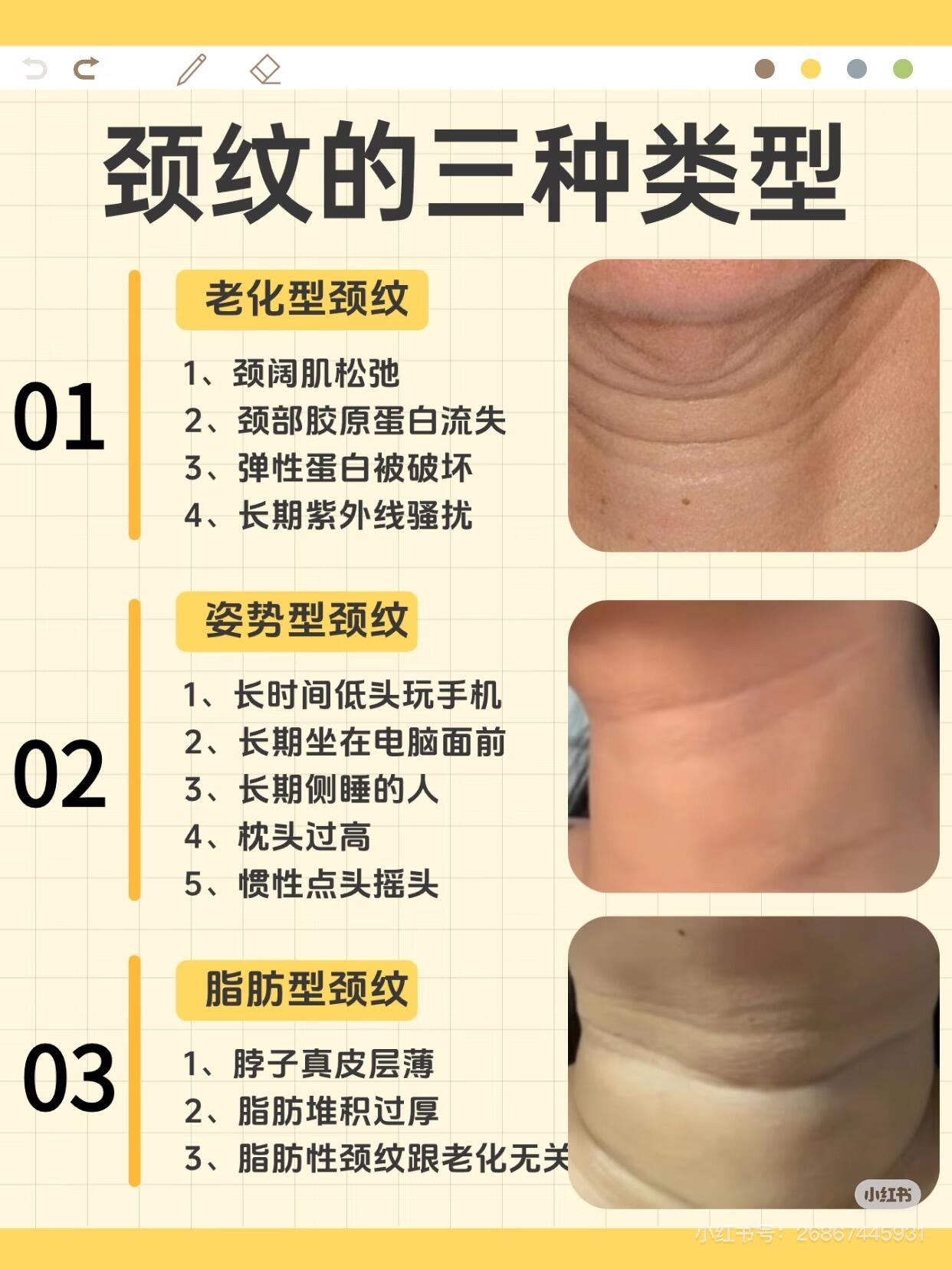 　手把手教你|颈霜专家推荐的实用正确用法