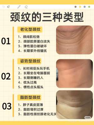 手把手教你|颈霜专家推荐的实用正确用法