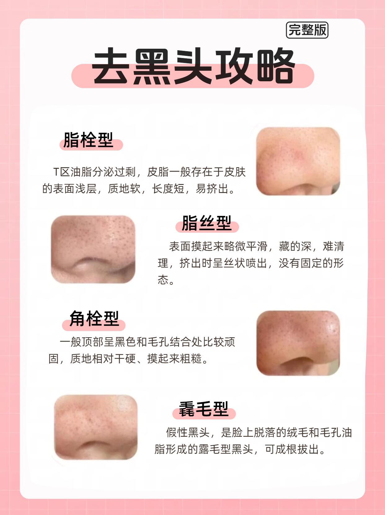 干性肌肤去黑头最新趋势分析与行业未来展望