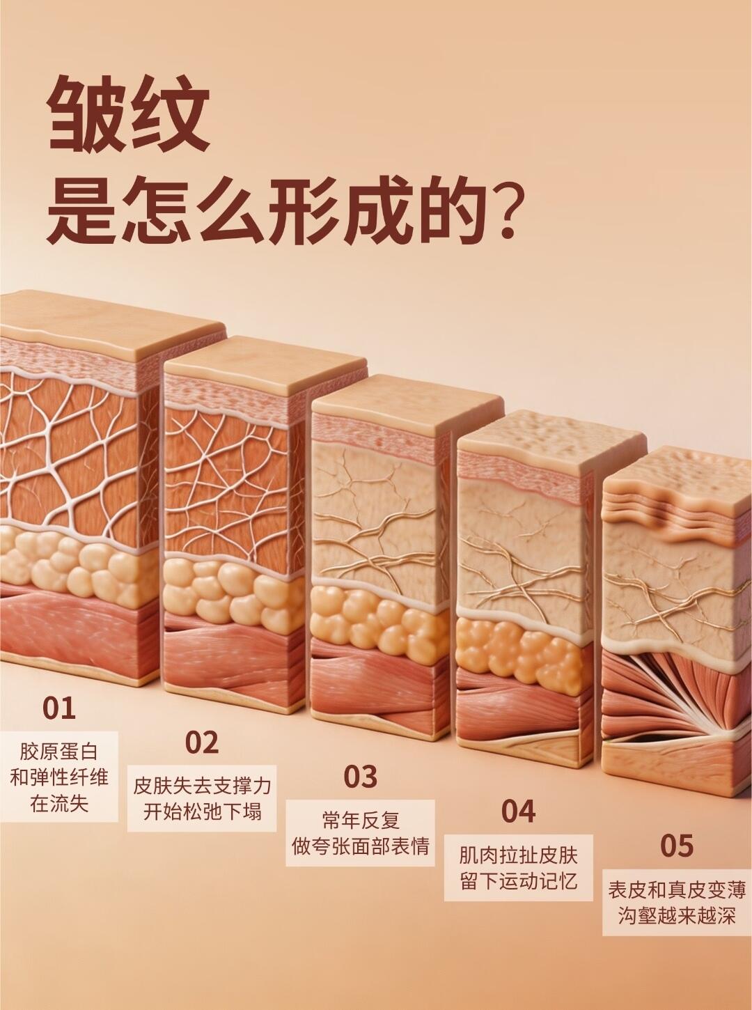 哺乳期去皱纹最新趋势分析与未来展望