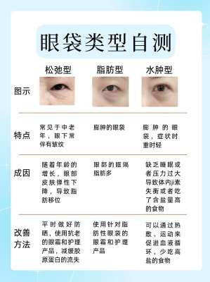 青少年去眼袋全面解析|专属核心要点、科学方案与避坑指南