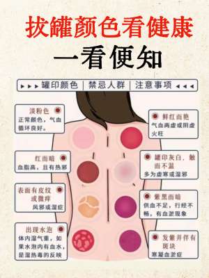 中医拔罐技巧核心要点全面解析(实操完整版)