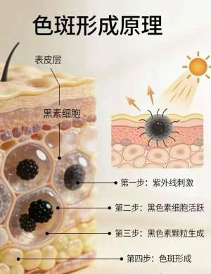 祛斑成分最新趋势分析与未来展望(2026行业深度版)