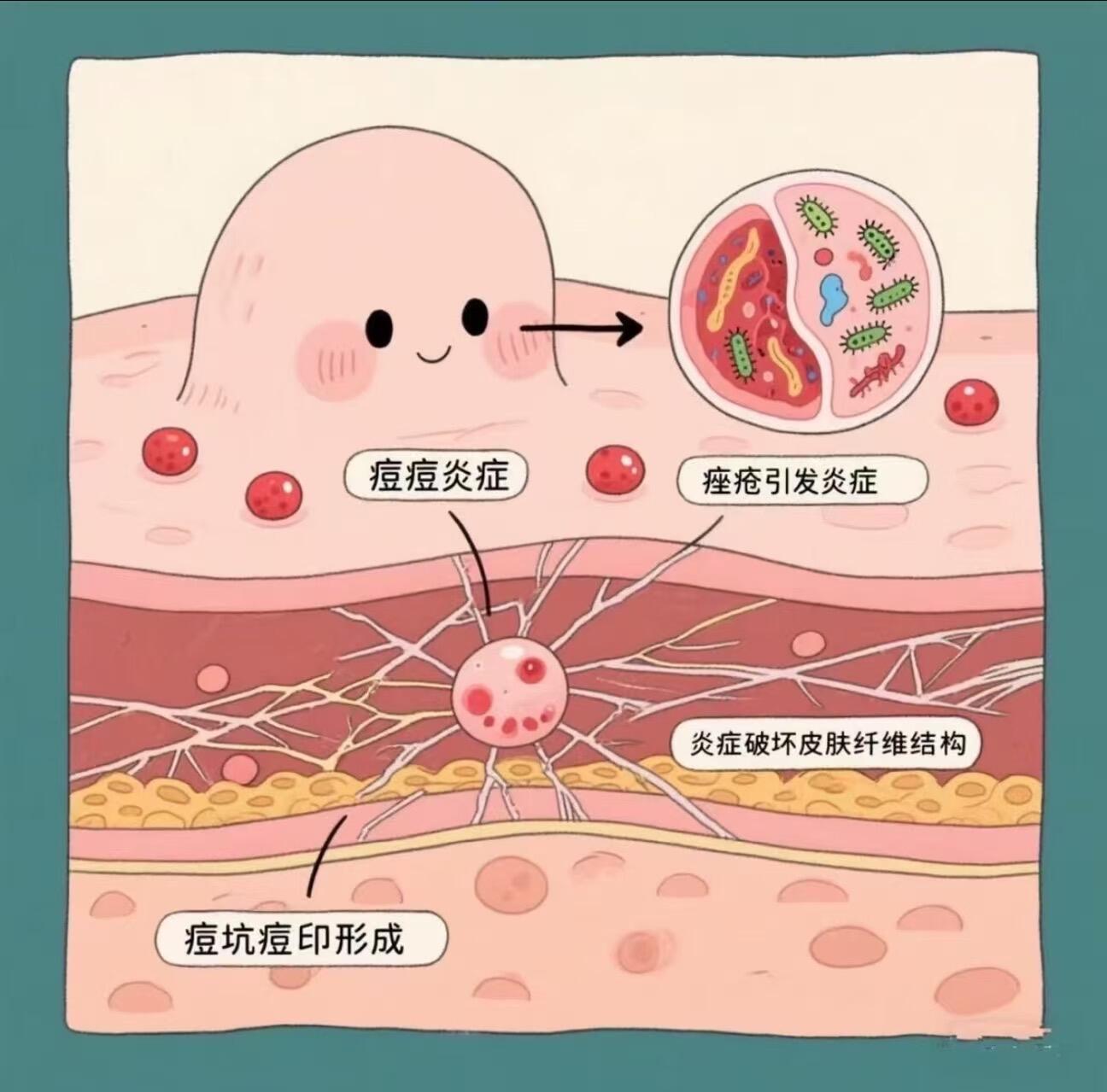 全面解析祛痘安全性评估的核心要点