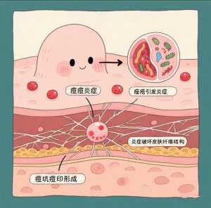 全面解析祛痘安全性评估的核心要点